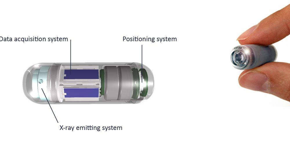 Prevenzione e diagnostica del tumore al colon: la rivoluzione nasce al Politecnico di Como