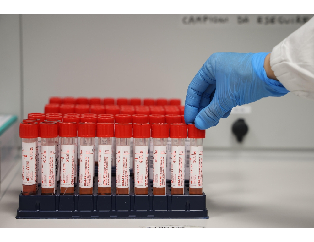 Covid: in Puglia 15 morti e 6.670 nuovi casi,il 17% dei test